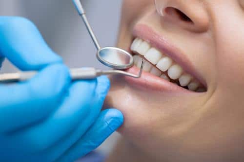 Limpieza Dental - Dental Plus Cancún